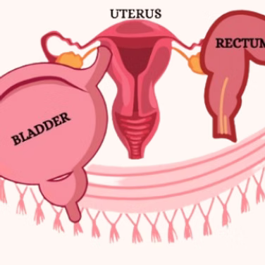 What to do if you have pelvic floor prolapse?